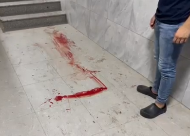 الاحتلال يصيب شابا بجروح خطيرة في الرأس ويعتقله في كفر عقب