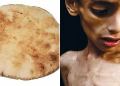أطفال غزة يموتون من الجوع